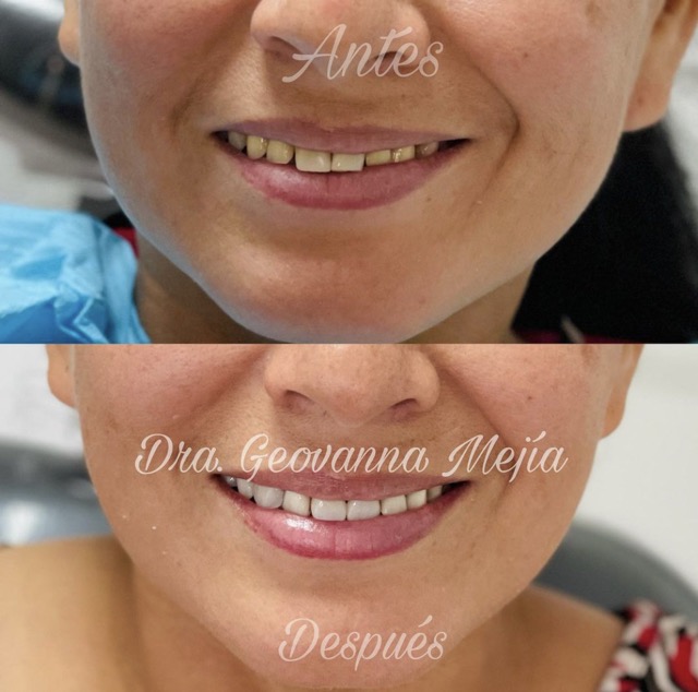 Clínica Dental Guayaquil GMC Dental CONSULTA Dental y Ortodoncia